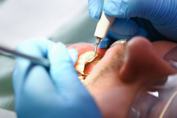 Best Cracked Tooth Emergency Dentist  in Newtown, OH