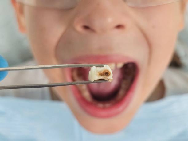 Best Emergency Tooth Extraction  in Newtown, OH